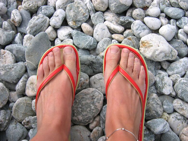 Wear shoes on the beach to prevent fungus