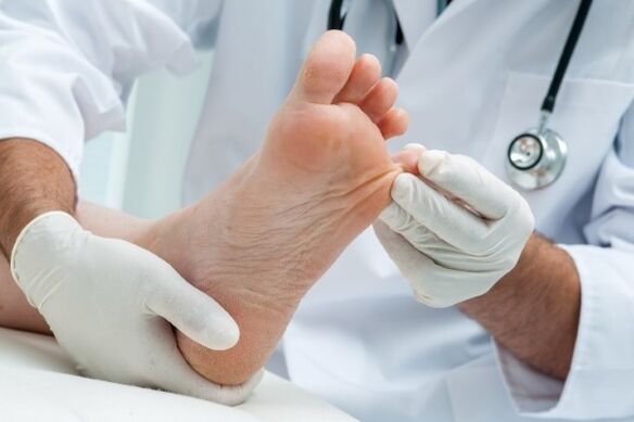 Fungal treatment