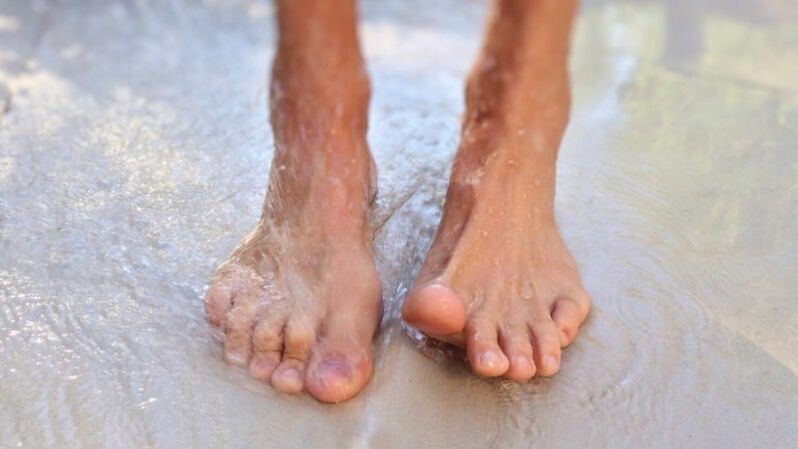 Fungal infection