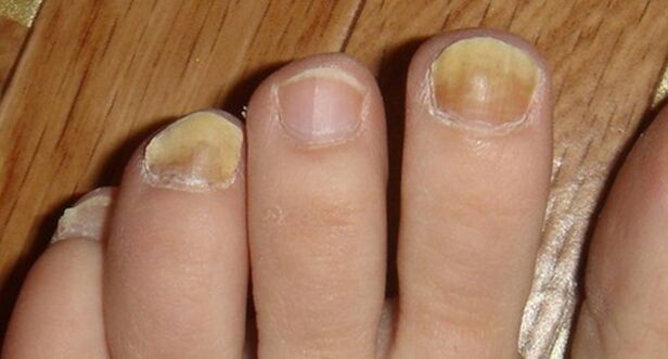 Change the color and structure of nails