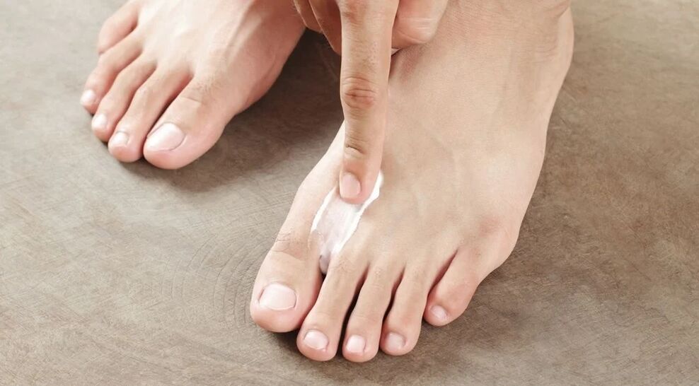 Apply butter from the fungus between your fingers