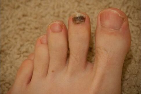 Use oral and topical medications