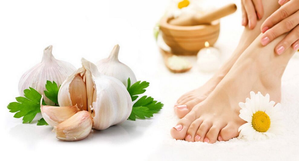 Garlic treats onychomycosis