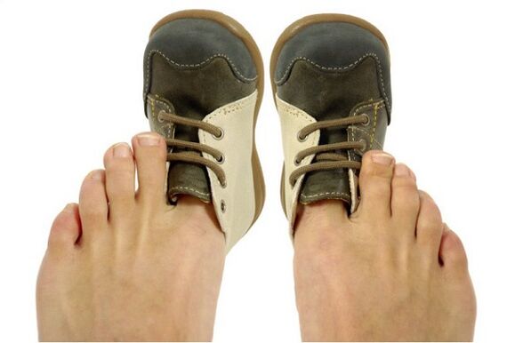 How to identify onychomycosis by symptoms
