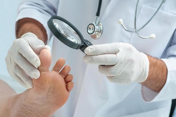 Toenail fungus causes and treatments